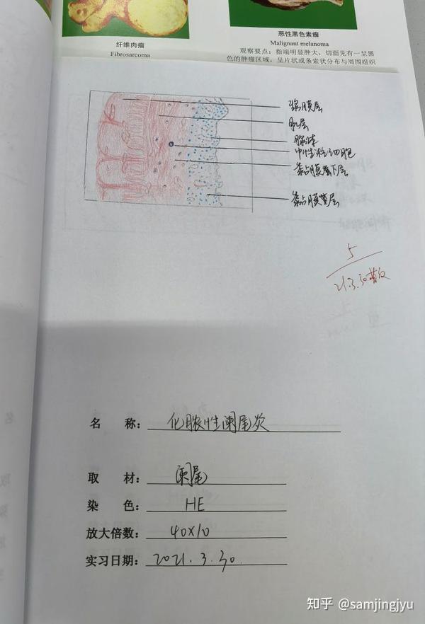 病理学实验红蓝铅笔手绘