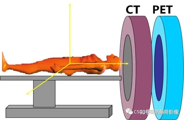 pet/ct:既能早期发现病灶,又可以准确定位