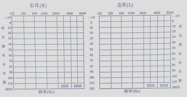 如何快速阅读纯音测听报告?