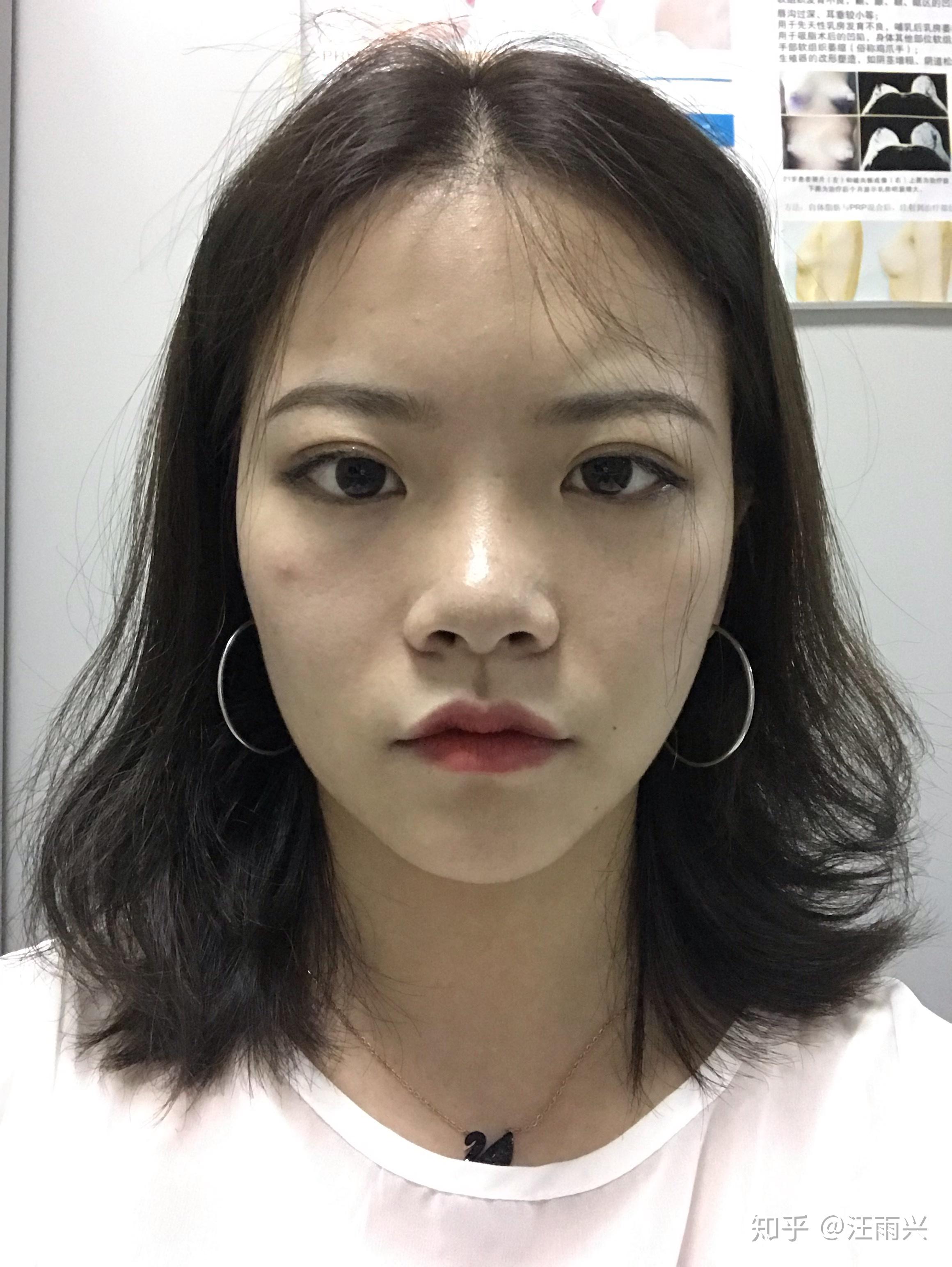 鼻子大的女生都不好看