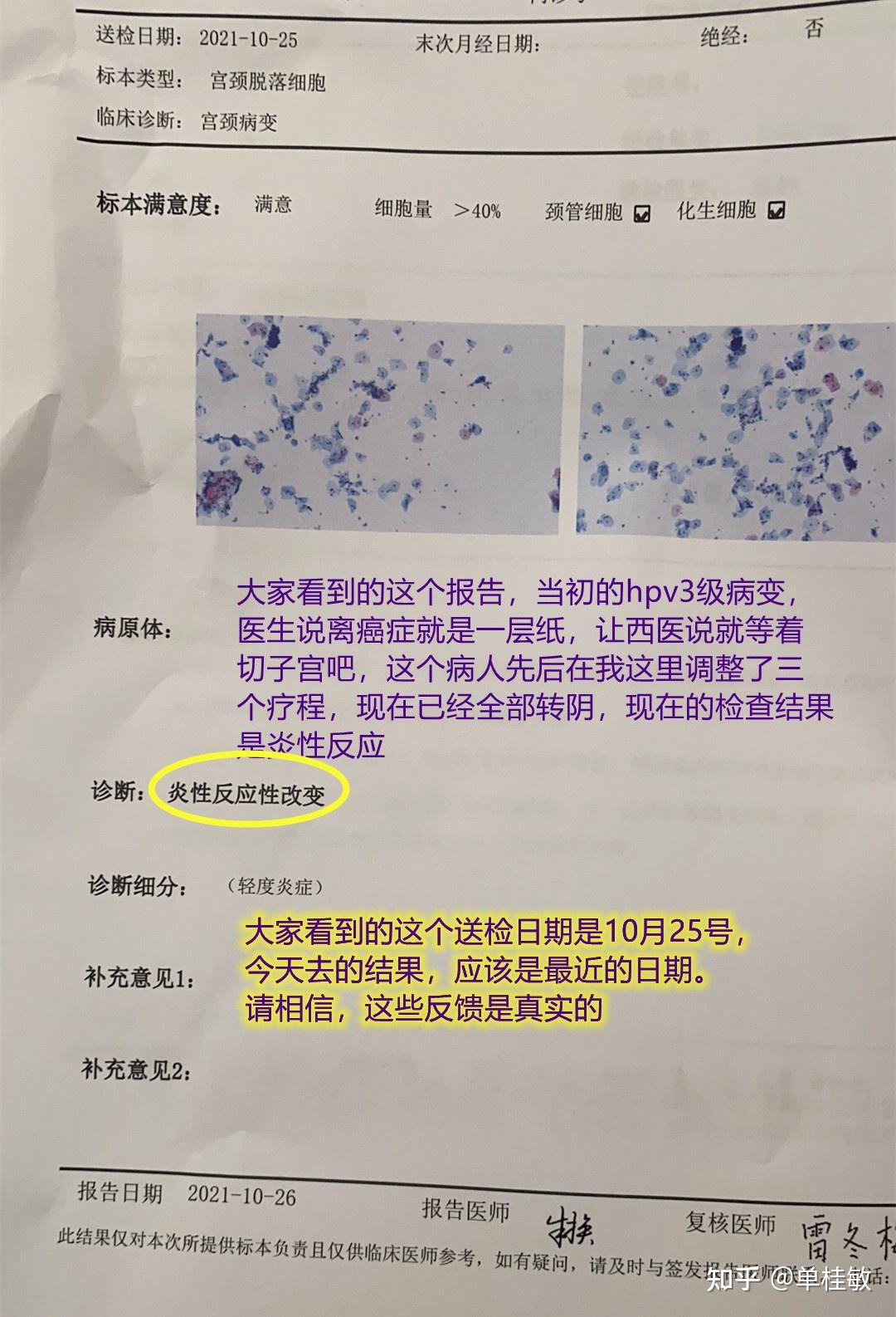 hpv高危3级病变火针治愈
