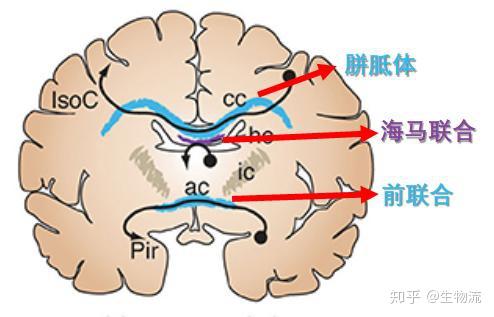 前脑联合分为胼胝体,海马联合和前联合
