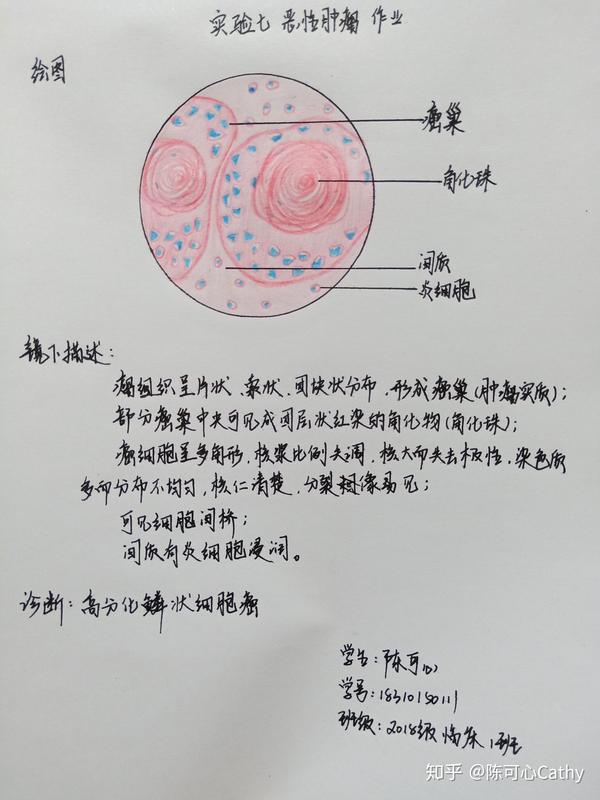 病理学红蓝铅笔绘图 实验作业