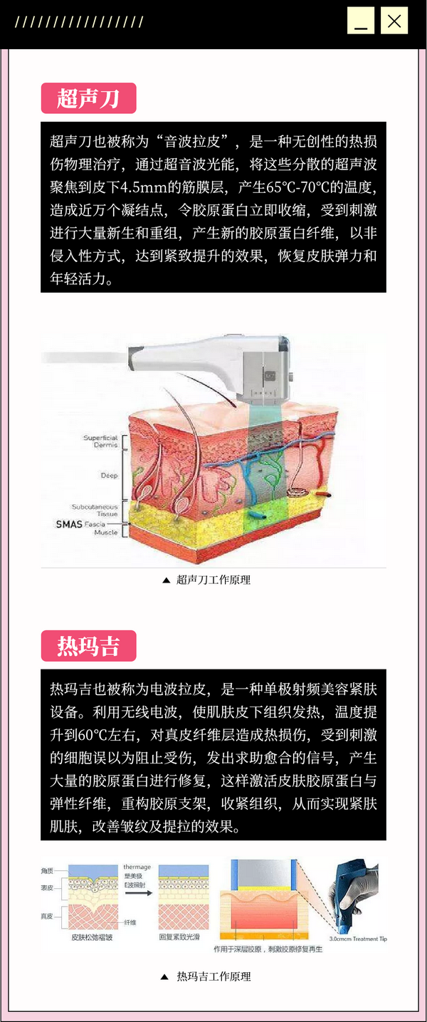 科普超声刀与热玛吉