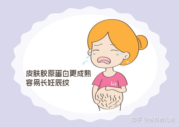 都是孕妇,为啥有人不长妊娠纹?这几类女性容易中招