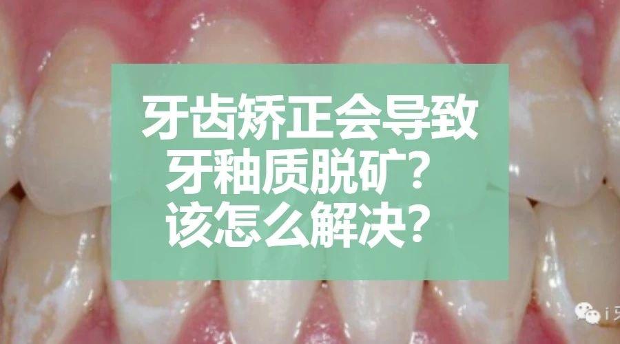牙齿矫正会导致牙釉质脱矿?该怎么解决?