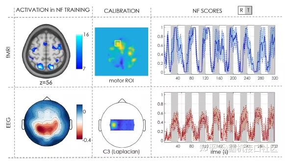 在神经反馈任务中同时进行EEG fMRI多模态数据集成的大脑成像数据集 知乎