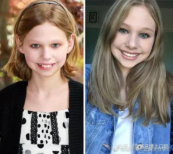 如何不动声色的变美,惊艳整个朋友圈?