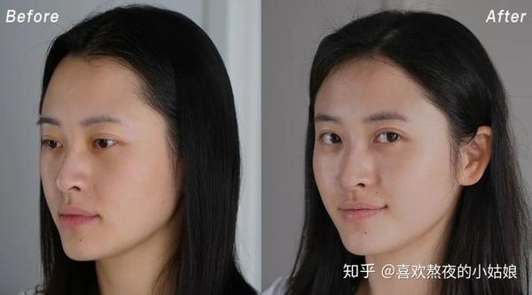 晒黑后如何快速白回来?