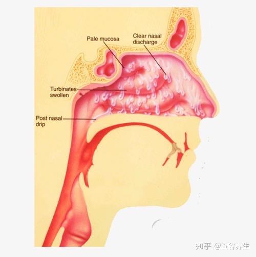 99%的人不知道受凉后为什么会鼻塞?