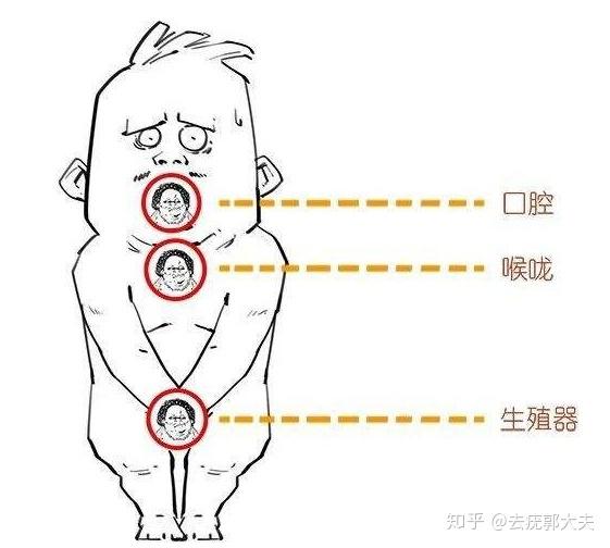 男性尖锐湿疣怎么治疗?治疗方法以及优缺点都有哪些?