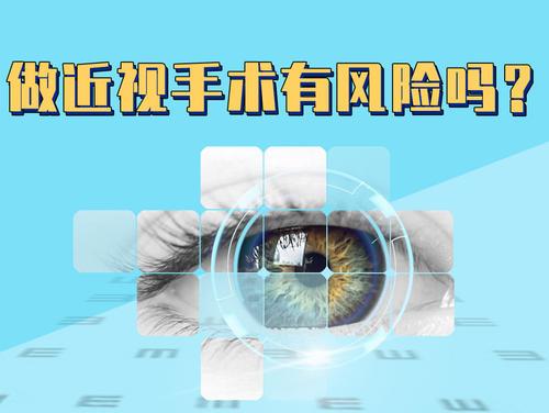 想做近视手术的小伙伴们看过来!