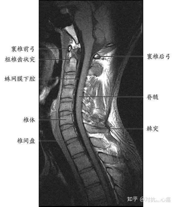 从乡下学来的土方法,让我在家治(腰间盘突出),十分方便
