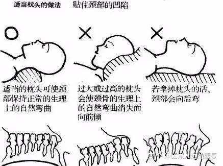 肩颈痛别忽视,可能隐藏着大问题!