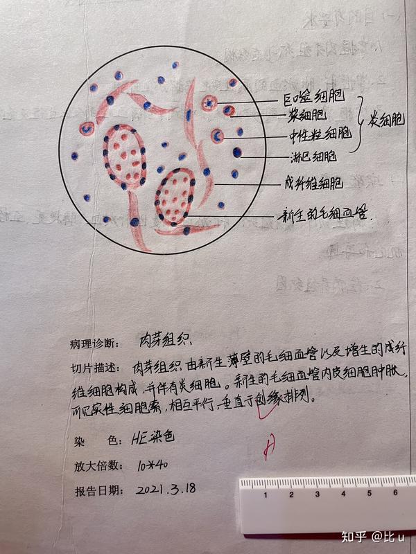 病理学实验绘图红蓝铅笔