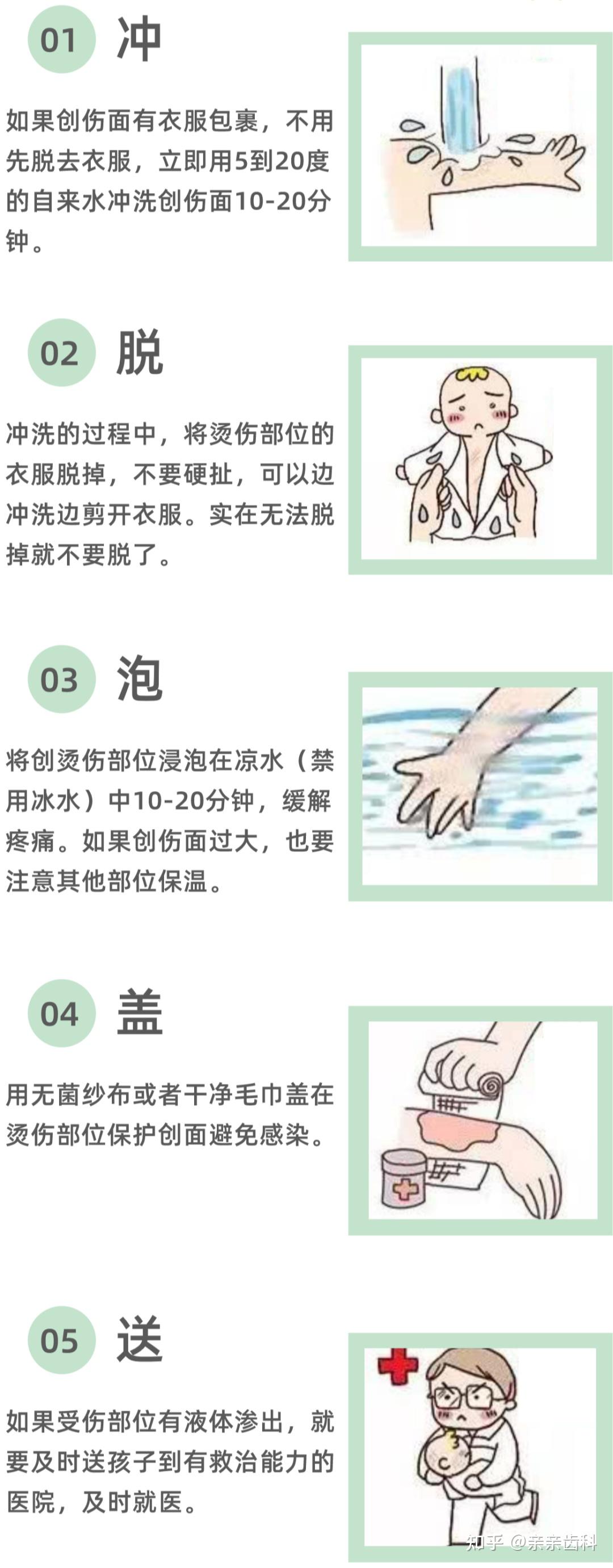 孩子烫伤后最佳处理时间只有2分钟这些急救措施请熟记