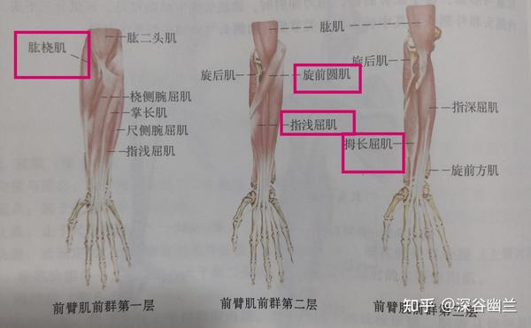 皮下组织→肱桡肌→桡侧腕屈肌→指浅层肌与旋前圆肌之间→拇长屈肌