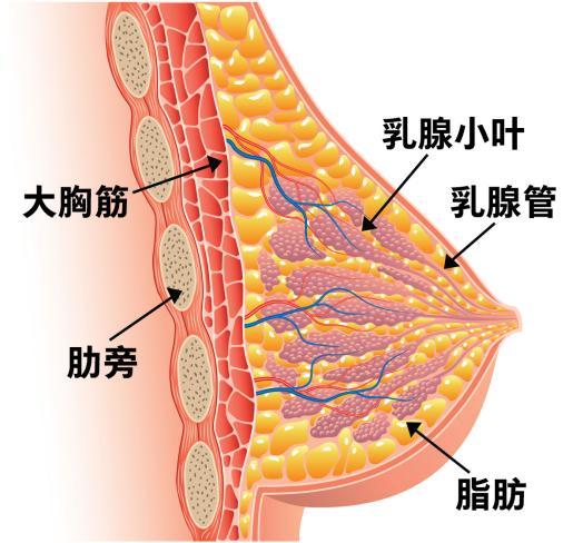 乳腺癌还有一个阶段称为0期癌症