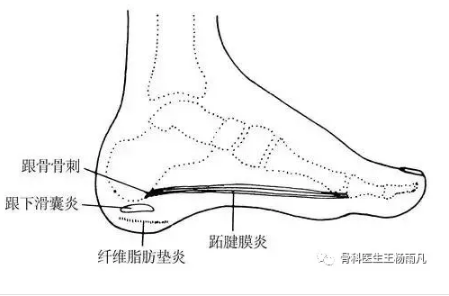 首发于谈骨论筋 写文章 登录