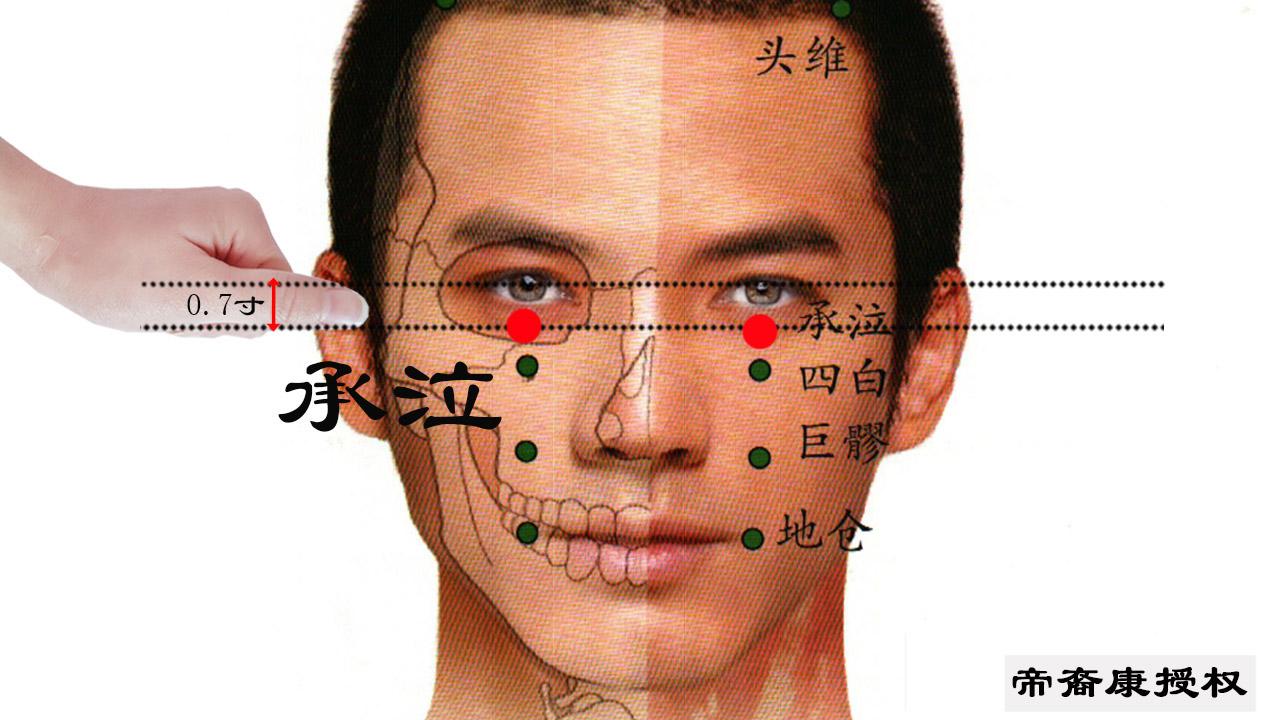 急慢性结膜炎只要通过承泣穴就能治疗