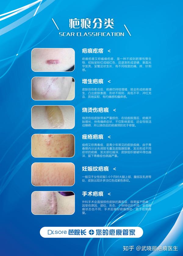 瘢痕和疤痕的区别 zhuanlan.zhihu.com