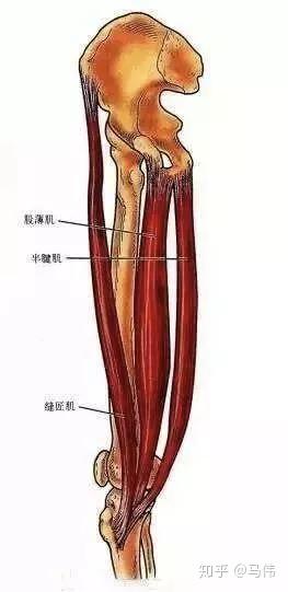 膝内侧痛小心鹅足腱炎