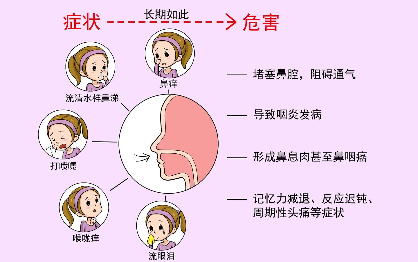 春季过敏性鼻炎高发教您如何防治