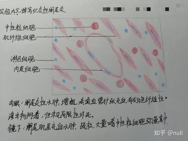 自己画的 也不怎么好看 骨骼肌 复层扁平上皮 小肠绒毛 肝 肺 肾上腺