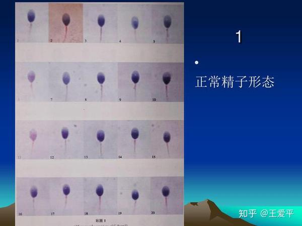 正常精子形态