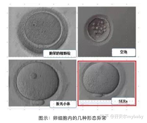 我的卵子是否完美