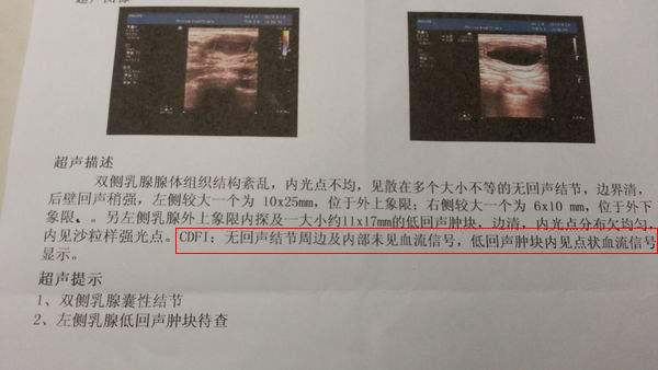 21 人 赞同了该文章 女性在做乳腺b超或彩超时,报告结果超声描述里