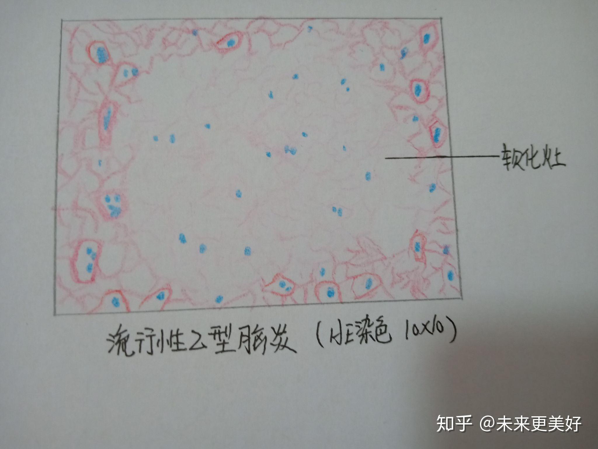 病理学切片红蓝铅笔手绘图