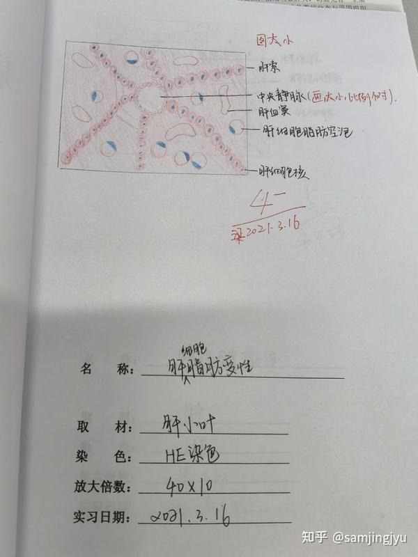 病理学实验红蓝铅笔手绘