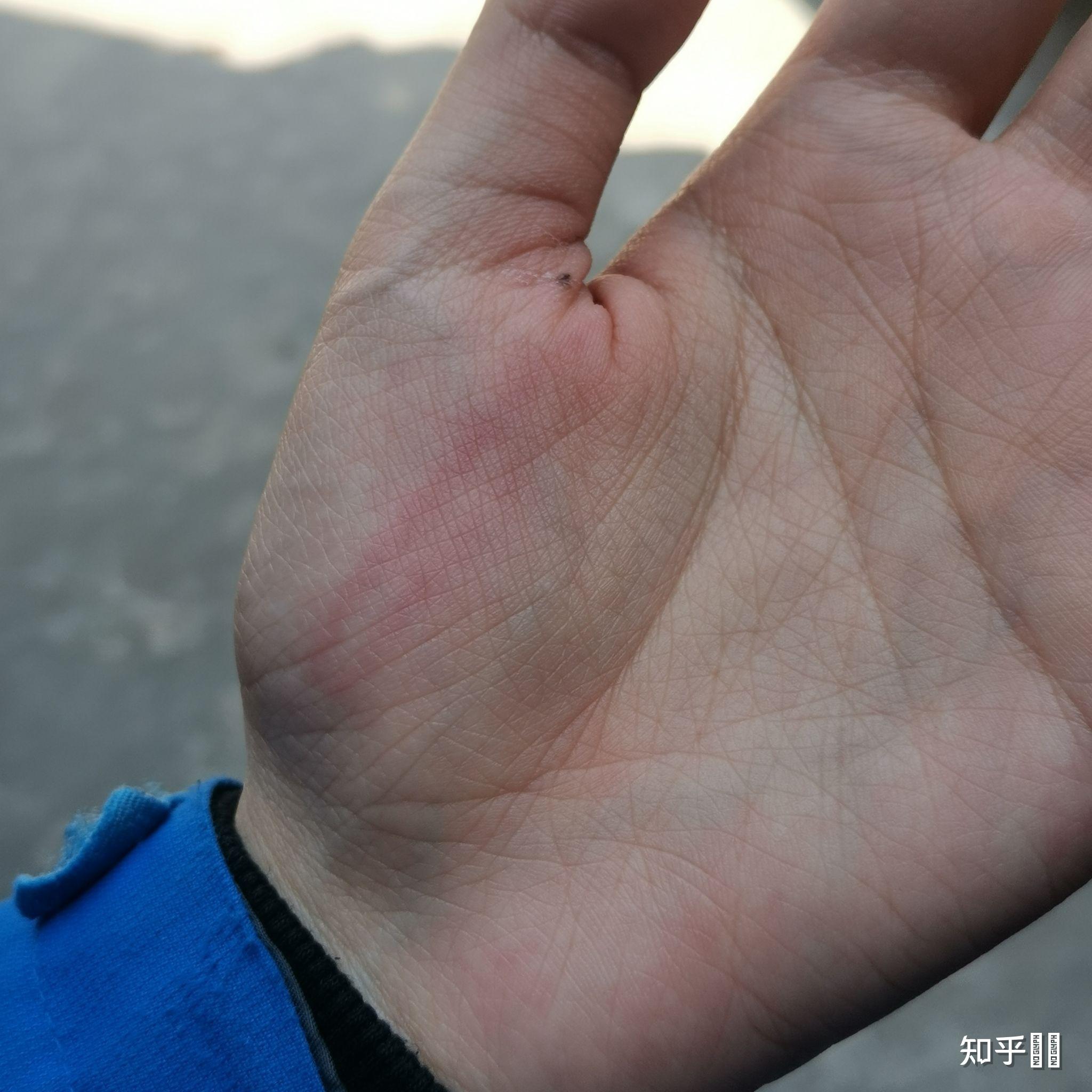 有人被老师打过手心吗具体说下过程谢谢