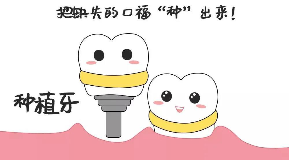 缺牙星人的自救指南带你一次get植牙攻略