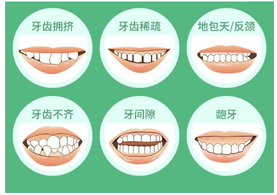 上海牙齿矫正/正畸大概要花多少钱?哪些口腔医院正规?