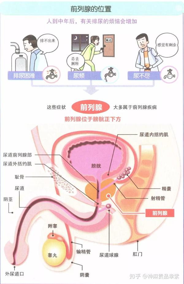 那么,作为男性的生命腺,前列腺是如何对泌尿系统进行刺激,从而产生