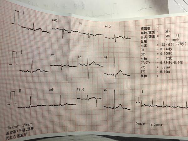 然后医生问了一下我的情况给我做了心电图