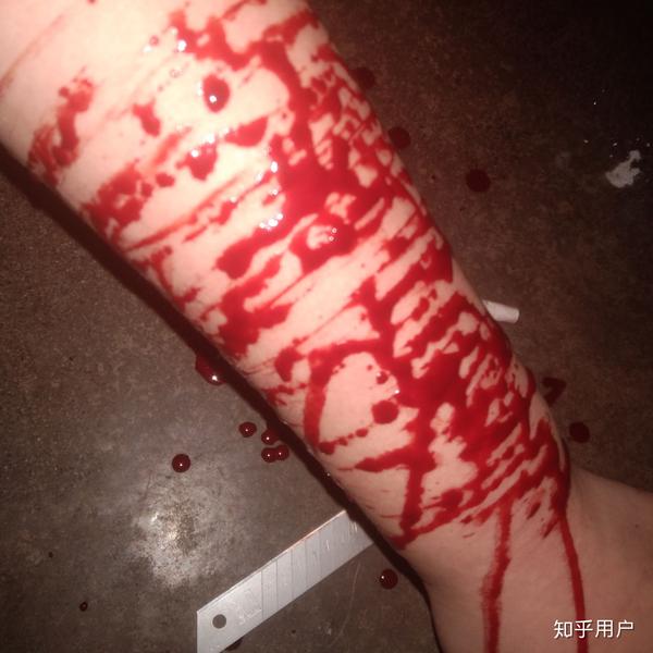 是不是自残过的人都会对自残上瘾,然后不管疼痛,不论伤疤,纵使知道会
