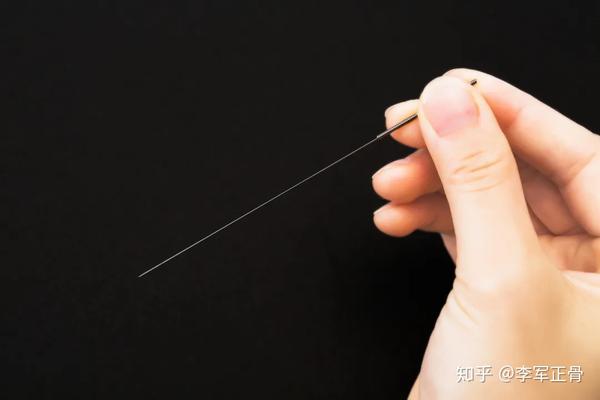 针灸技巧经验19个常见病的针灸口诀精辟