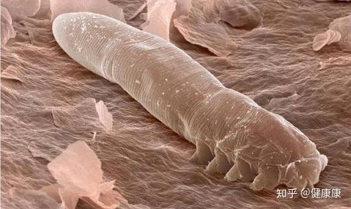 蠕形螨虫对于油性肤质,免疫力低下的人,容易因毛囊蠕形螨虫吞食人体