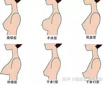 常见的乳房形状有哪几种?