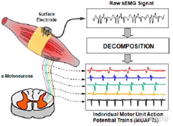 干货一文详解semg表面肌电