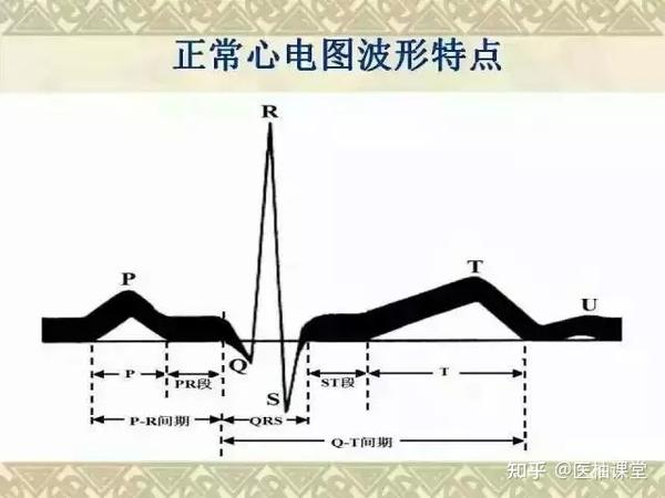 正常心电图波形特点