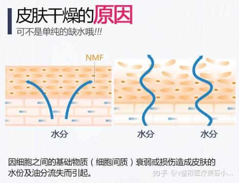 过度清洁,洗脸时用力摩擦,敷面膜时间过长致使皮肤水合过度等可导致