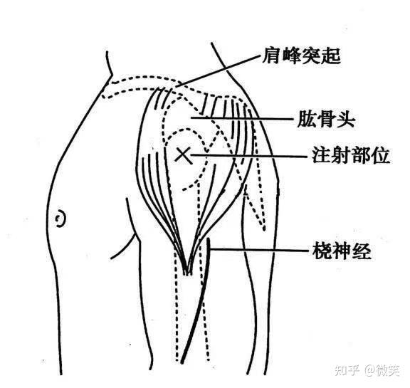 护考图片题
