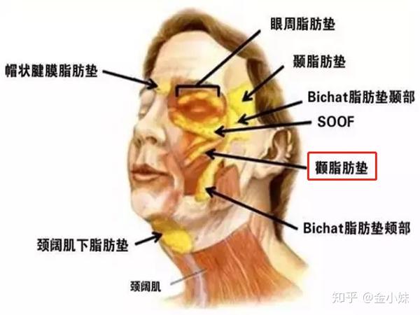 首先我们来看一个面部构造图,苹果肌主要是这块区域,即图中的颧脂肪垫