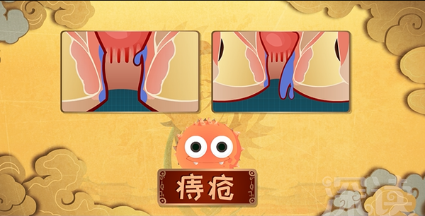 再现菊花长痔疮的全过程,爆笑上演最重口味动画