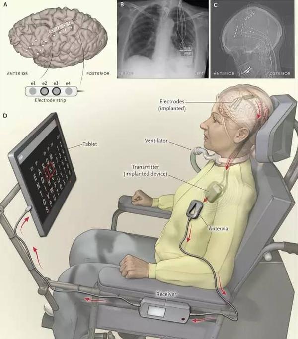 系统设备示意图