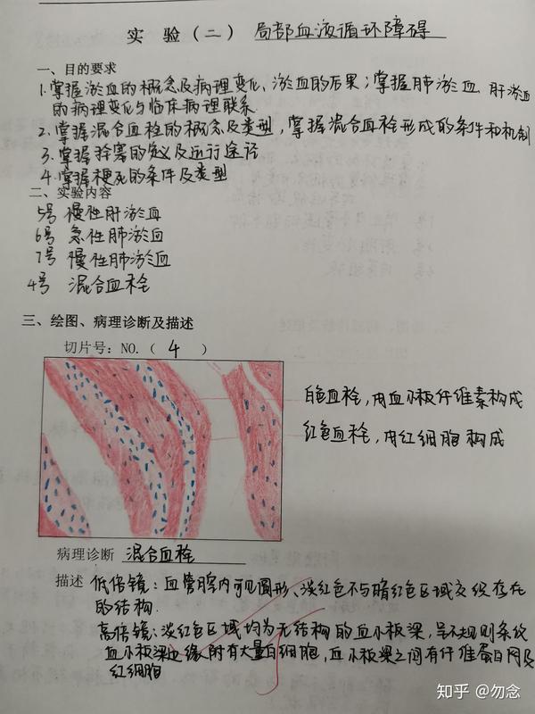 病理实验肝脂肪变性混合血栓肺脓肿急性蜂窝组织阑尾炎绘图病理诊断及